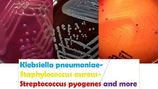 Klebsiella Streptococcus and Staphylococcus Colony Morphology Demonstration [upl. by Oalsinatse]