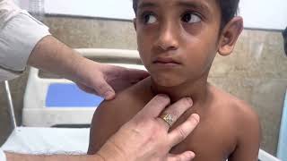 Respiratory system examination of children by Dr Deo Kumar JhaMDPediatric Pulmomologist [upl. by Laikeze]