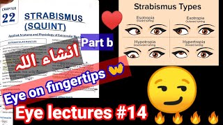 Eye lectures 14  Strabismus Squient exotropia entropia hypertropia hypotropia eye hirshburg [upl. by Dlanger]