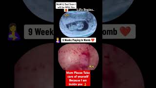 9 Weeks Baby Growing Inside Womb Pregnancy Ultrasound baby pregnancy babyboy babygirl boy [upl. by Gusty]