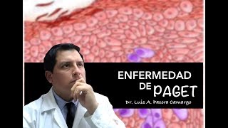 ENFERMEDAD DE PAGET ❗El CÁNCER ⚠️ de PEZÓN 😱 [upl. by Eloc]