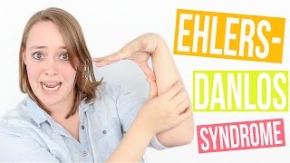 MY EHLERSDANLOS SYNDROME DIAGNOSIS STORY [upl. by Eirrek]