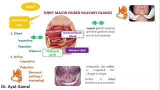 III Salivary glands how to examine parotid and submandibular SGs [upl. by Trebla]