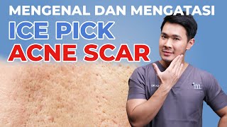 MENGENAL DAN MENGATASI ICE PICK SCAR ACNE [upl. by Des678]