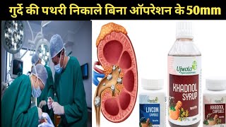 पथरी निकाले बिना ऑपरेशन के  livcon capsule khadnol syurp  khadnol livcon capsule khadnol syrup [upl. by Ayenet]