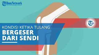 Dislokasi Kondisi ketika Tulang Keluar atau Bergeser dari Posisi Normalnya pada Sendi [upl. by Hime]