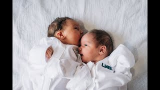 Double uterus double babies Alabama mom delivers rare twins at UAB [upl. by Meier]