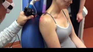 Laser Scar Removal in Richmond Va [upl. by Morganica]