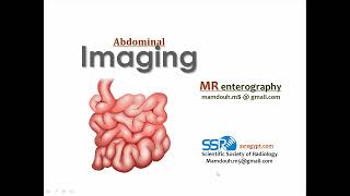 3 MR enterography technique amp clinical applications Prof Mamdouh Mahfouz [upl. by Irmina687]