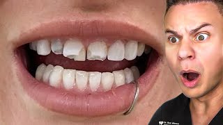 Orthodontist Reacts To WEIRDEST Teeth On TikTok [upl. by Saitam]