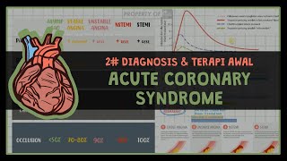 12 DIAGNOSIS DAN TERAPI SINDROM KORONER AKUT 2 ISCHEMIC HEART DIASEASE [upl. by Llerrit560]