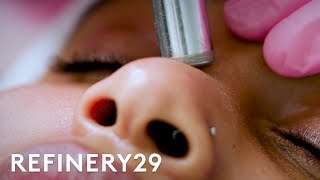 What Microdermabrasion Looks Like Up Close  Macro Beauty  Refinery29 [upl. by Flavia]