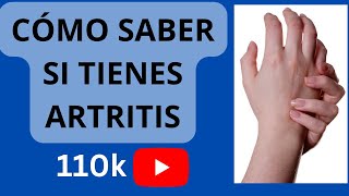 CÓMO SABER SI EL DOLOR QUE TIENES ES ARTRITIS [upl. by Priscella]