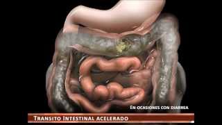 sindrome de intestino irritable [upl. by Livingstone]