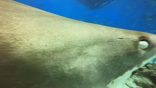 Both Lower Legs Severed in Tiger Shark Attack [upl. by Quintina]