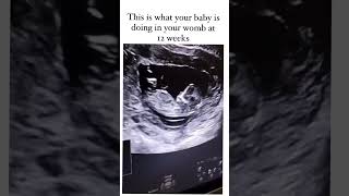 This is What You Baby is Doing in Your Womb at 12 Weeks  3 Month Pregnancy  pregnanvy [upl. by Ynattir354]