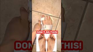 Bunion Corrector Exercises bunions bunion [upl. by Lathe]