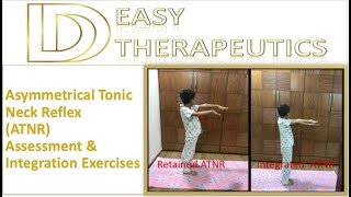 Asymmetrical Tonic Neck Reflex  ATNR Assessment amp Integration Exercises  Primitive Reflexes [upl. by Mayhs]