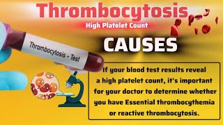 THROMBOCYTOSIS OR High Platelet Count  Cause  Symptoms  Complications  Treatment [upl. by Trow491]