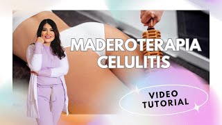 MADEROTERAPIA CELULITIS PIENAS [upl. by Ahsiugal990]