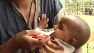 HealthPhone™ English  5 Appetite Testing Techniques  Management of Severe Acute Malnutrition [upl. by Neisa]