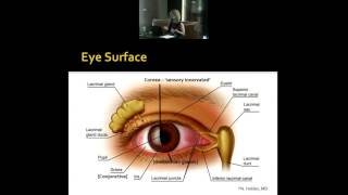 Relationships of Blepharospasm to Ophthalmologic Conditions such as Dry Eye [upl. by Llirpa]