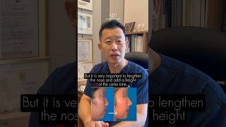 Asian Rhinoplasty  What you need to know before signing up [upl. by Doll]