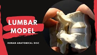 Lumbar Spine Anatomy Model  with Ligamentum Flavum and Interspinous Ligament [upl. by Ric]