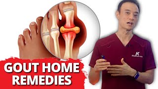 Relief Fast 6 Home Remedies For Gout [upl. by Eutnoj]