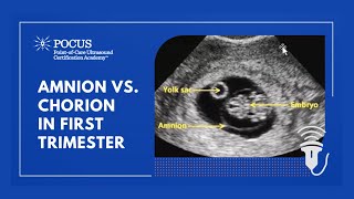 Difference Between Amnion and Chorion [upl. by Joyann]