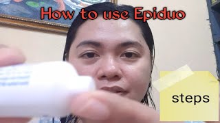 Epiduo Forte Gel Review [upl. by Llennahs762]