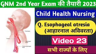 GNM 2nd Year Esophageal AtresiaVideo 23 Child Health Nursing आहारनाल अविवारताmedicalnursing [upl. by Dumanian181]