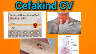 जब सभी एंटीबायोटिक फैल हो तब Cefakind cv 250  Cefuroxime Axetil amp Potassium Clavulanate Tablet [upl. by Allbee180]