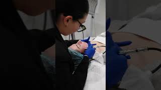 Microdermabrasion Facial [upl. by Aicenek]