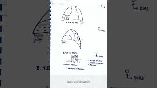 Épanchement pleural et ponction pleurale [upl. by Seward636]