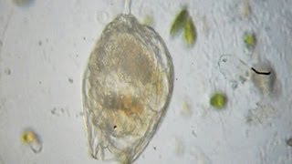 Rotifer  Lecane hamata [upl. by Ardyth]