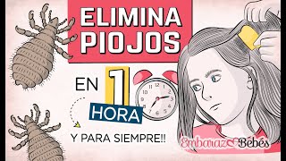 💇🏻‍♀️🔥 3 Remedios para ELIMINAR PIOJOS y Liendres en 1 HORA y para Siempre [upl. by Suzi]