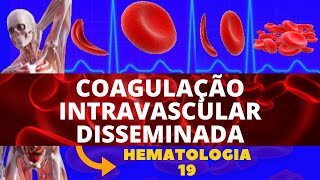 COAGULAÇÃO INTRAVASCULAR DISSEMINADA CIVD  HEMATOLOGIA [upl. by Assereht880]