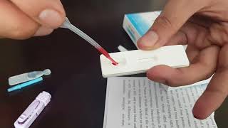 Showing a POSITIVE result on an In Home HIV rapid test kit [upl. by Nenerb]