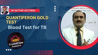 Quantiferon Gold TB Test  A Blood Serum test for TB Diagnosis [upl. by Lairret85]