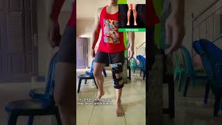 Knee Brace untuk Kaki XO [upl. by Roddy]