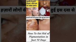 ayurvedic skin care products  ayurvedic pigmentation cream shorts [upl. by Nyrok756]