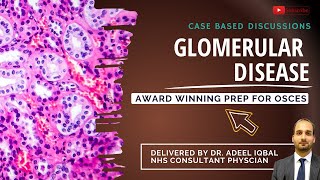 Glomerular Disease  Abdominal  BEST OSCE Preparation for Medical Student Exams [upl. by Nnasor]