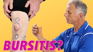 What Is Causing Your Knee Pain Bursitis How To Tell [upl. by Brendin503]