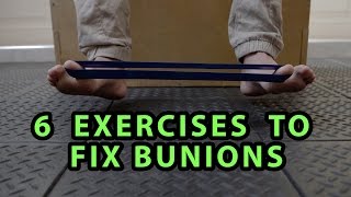 6 Exercises to Fix Bunions [upl. by Hgielram]