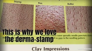 Dermapen Dermaroller DermaStamp HELP HELP [upl. by Nodyl]