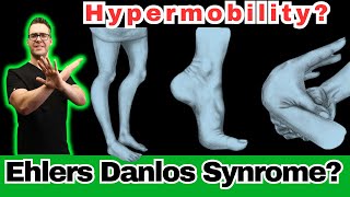 Ehlers Danlos Syndrome Hypermobility Symptoms Diagnosis amp Test [upl. by Drarej]