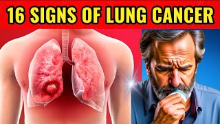 Lung Cancer Signs and Symptoms HealthTrendz3000 [upl. by Aitropal]