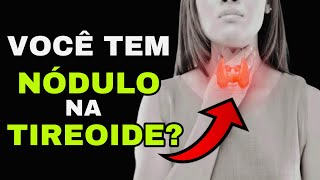 7 SINAIS PERIGOSOS de um NÓDULO na TIREOIDE Sintomas de Câncer na Tireoide [upl. by Patti]