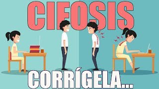 Corrige la CIFOSIS en 3 pasos  Higiene Postural [upl. by Ydnih]